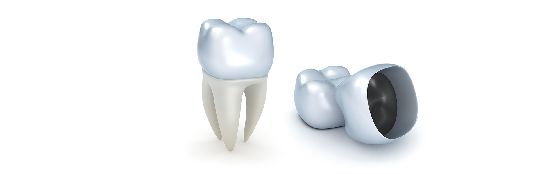 How do Dental Crowns Shield Your Teeth from Further Damage?