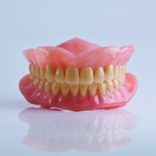 10 Things to Know Before Getting Implant-Supported Dentures